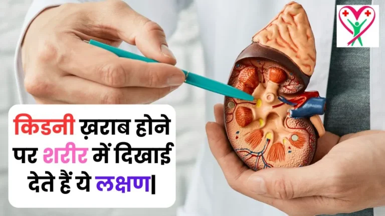 Kidney Kharab Hone Ke Lakshan